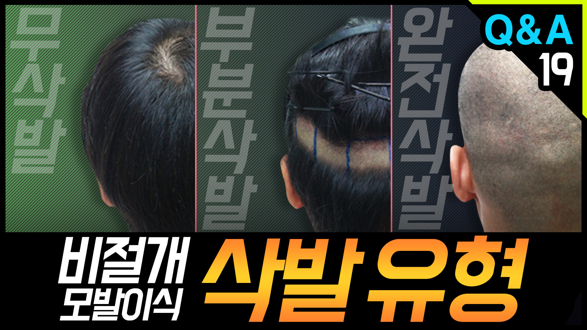 영상 썸네일